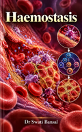 Haemostasis by Dr Swati Bansal