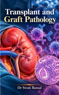 Transplant and Graft Pathology by Dr Swati Bansal